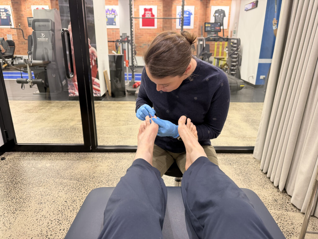 Podiatrist performing clinical Ingrown toenail treatment Melbourne